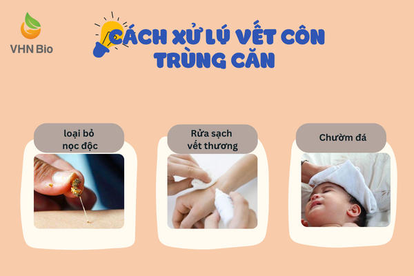 Cách hay giúp mẹ xử lý vết côn trùng cắn ở trẻ