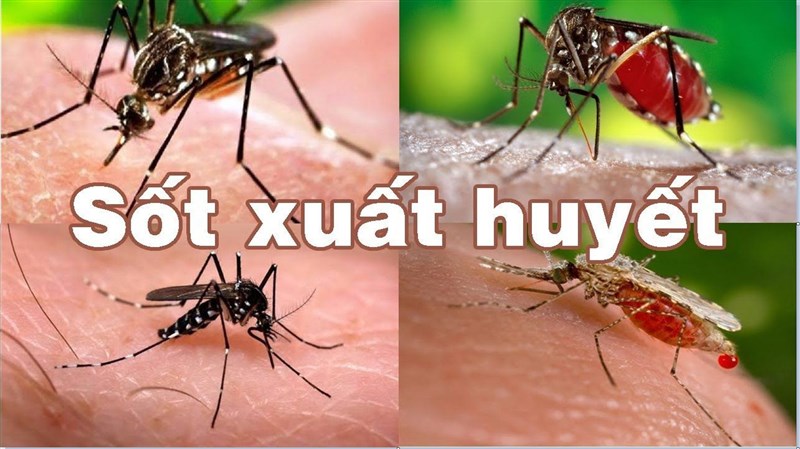 Sốt xuất huyết ở người lớn: Triệu chứng và cách điều trị