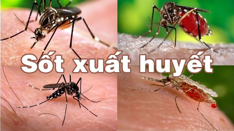 ​6 triệu chứng sốt xuất huyết trở nặng không thể không biết