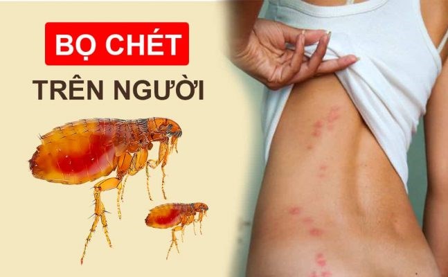 DỊCH VỤ DIỆT BỌ CHÉT TẬN GỐC CỦA GREENXPERTS